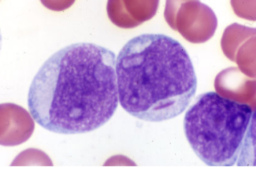 <p>which FAB classification is associated with the following information?</p><ul><li><p>blasts 90% of non-erythroid cells in BM</p></li><li><p>&lt;10% of cells show maturation up to myeloctes </p></li></ul><p></p>