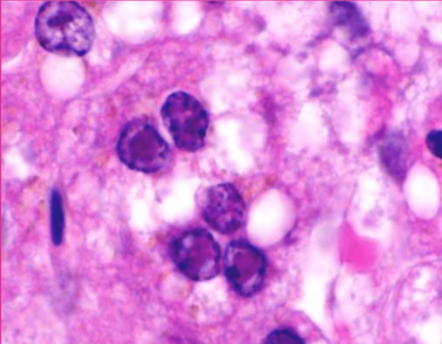 <p>which viral inclusion?</p>