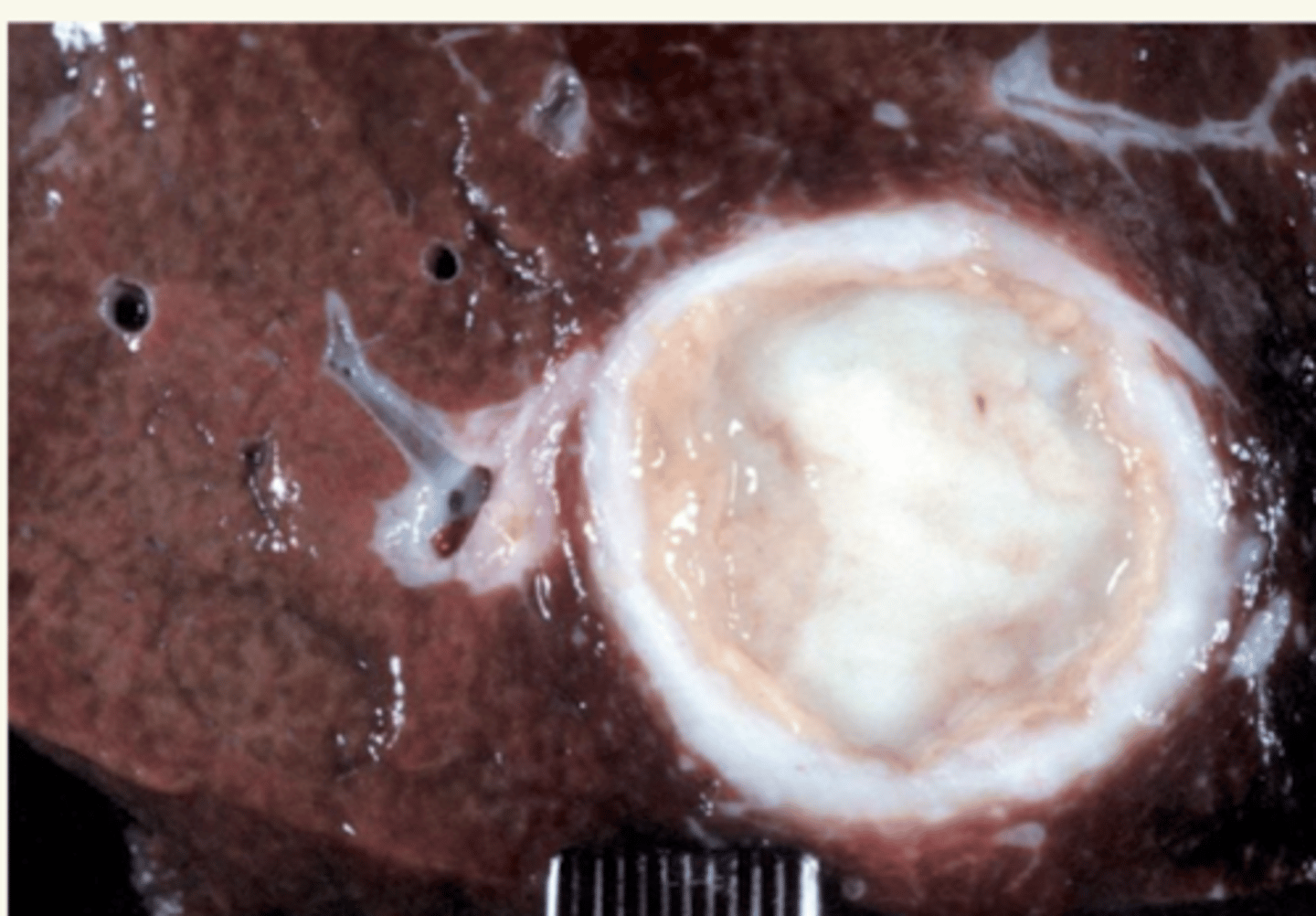 <p>¿diagnóstico morfológico y etiológico?</p>