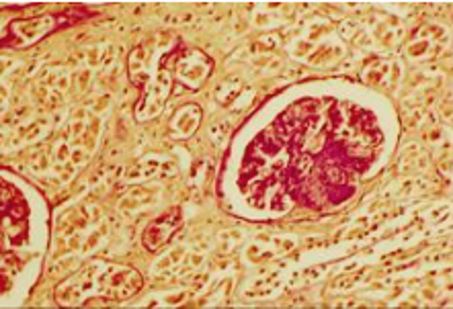 <p>A ______ is a tiny structure produced by the kidneys and present in urine that contains indicators of urinary health.</p>