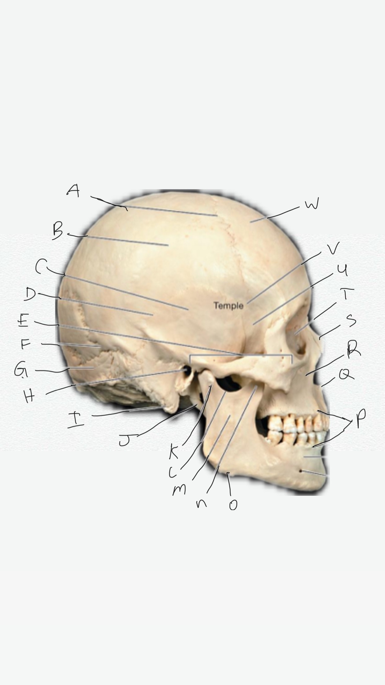 <p>V</p>