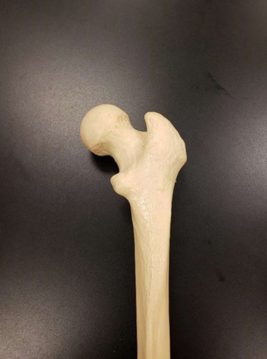 <p>anterior/posterior proximal/distal of the femur</p>