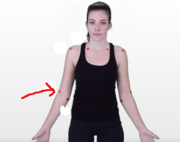 <p>The dermatomal area where the arrow is pointing would indicate what level? </p>
