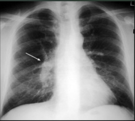 <p>What is the arrow pointing to on this PE?</p>