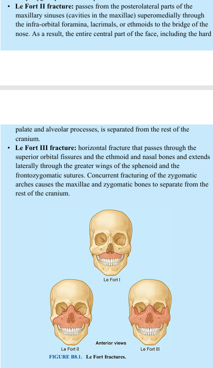 <p>Dr. Léon-Clement Le Fort (a Paris surgeon and gynecologist, 1829–1893) classified three common variants of fractures of the maxillae (Fig. B8.1): • Le Fort I fracture: wide variety of horizontal fractures of the maxillae, passing superior to the maxillary alveolar process (i.e., to the roots of the teeth), crossing the bony nasal septum and possibly the pterygoid plates of the sphenoid • Le Fort II fracture: passes from the posterolateral parts of the maxillary sinuses (cavities in the maxillae) superomedially through the infra-orbital foramina, lacrimals, or ethmoids to the bridge of the nose. As a result, the entire central part of the face, including the hard palate and alveolar processes, is separated from the rest of the cranium. • Le Fort III fracture: horizontal fracture that passes through the superior orbital fissures and the ethmoid and nasal bones and extends laterally through the greater wings of the sphenoid and the frontozygomatic sutures. Concurrent fracturing of the zygomatic arches causes the maxillae and zygomatic bones to separate from the rest of the cranium.</p>