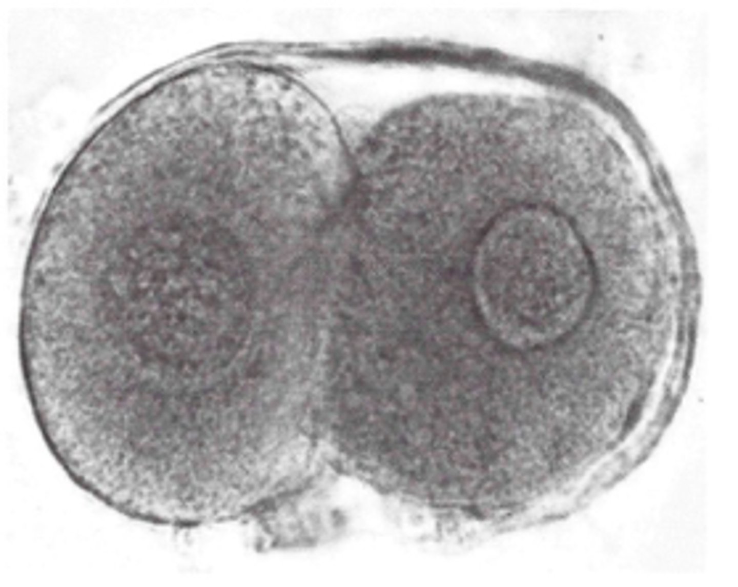 <p>identify the stage of fertilization:</p>