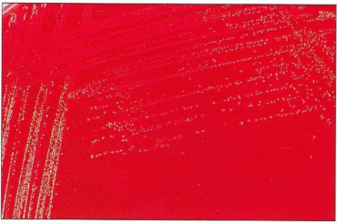 <ol><li><p><em><u>Erysipelas rhusiopathiae</u></em></p></li><li><p>Sheep blood Agar</p></li><li><p>Non-hemolytic</p></li><li><p>24hrs</p></li></ol><p></p>