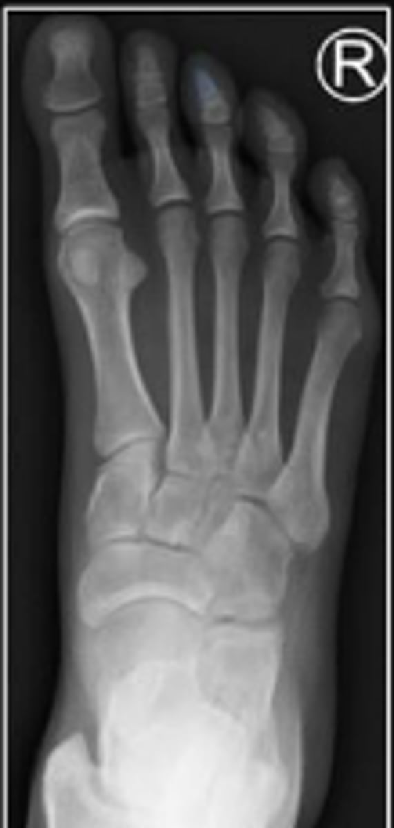 <p>What is outlined?</p>