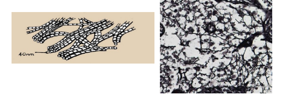<p>Type III collagen - branched </p>