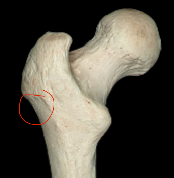 <p>indent under greater trochanter of femur </p>