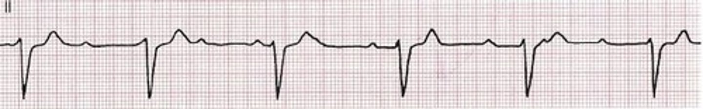 <p>adv.一貫地，始終如一地</p>