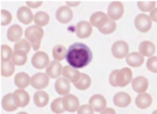 <p>identify the leukocyte</p>