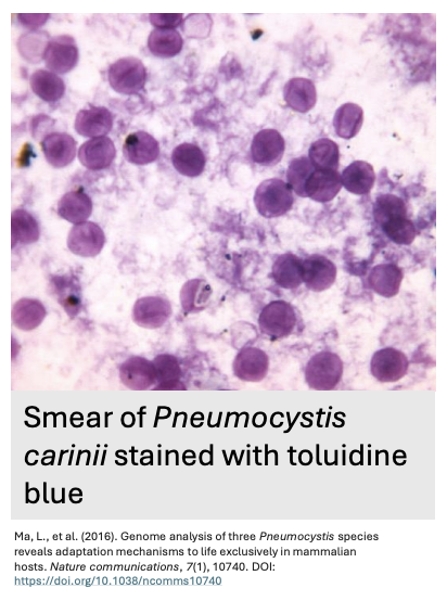 <ul><li><p>_ is the first identified member of the fungal kingdom that <strong>does not have chitin in its cell wall</strong></p></li><li><p>Describe the figure shown</p></li></ul><p></p>