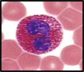 <p>A high Eosinophil count indicates what?</p>