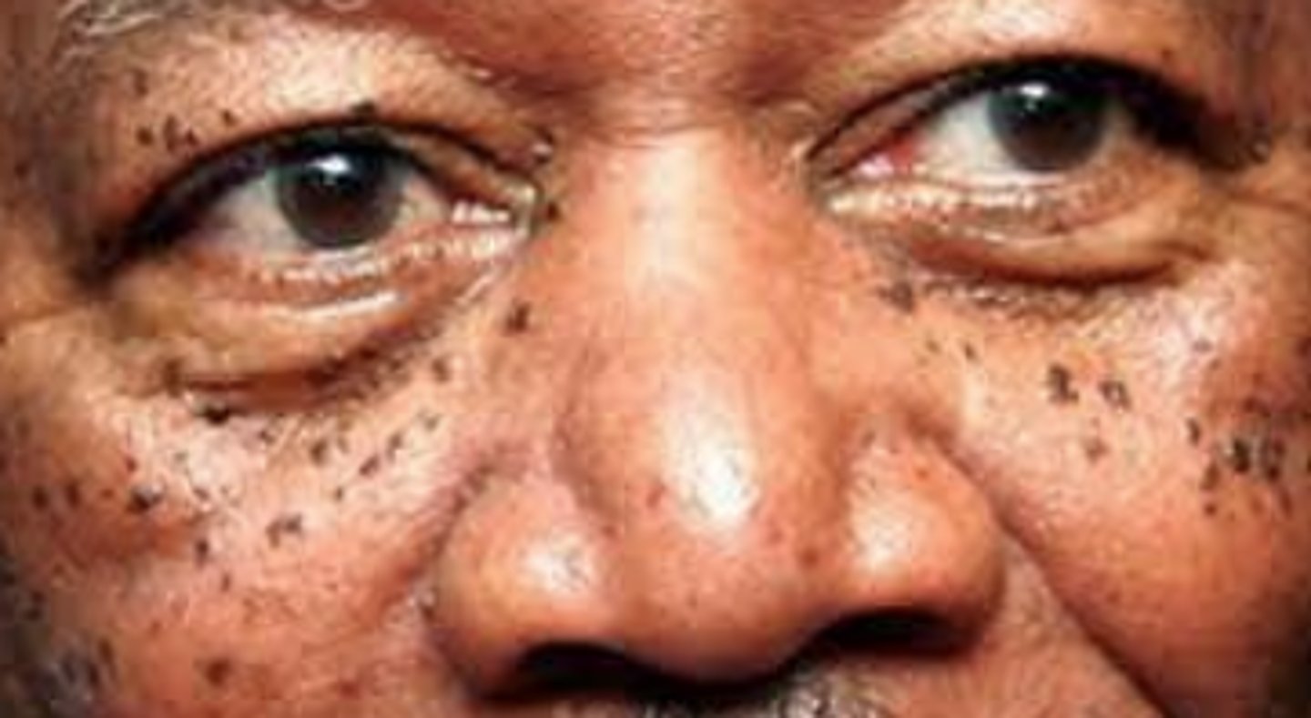 <p>African or Asian descent</p>