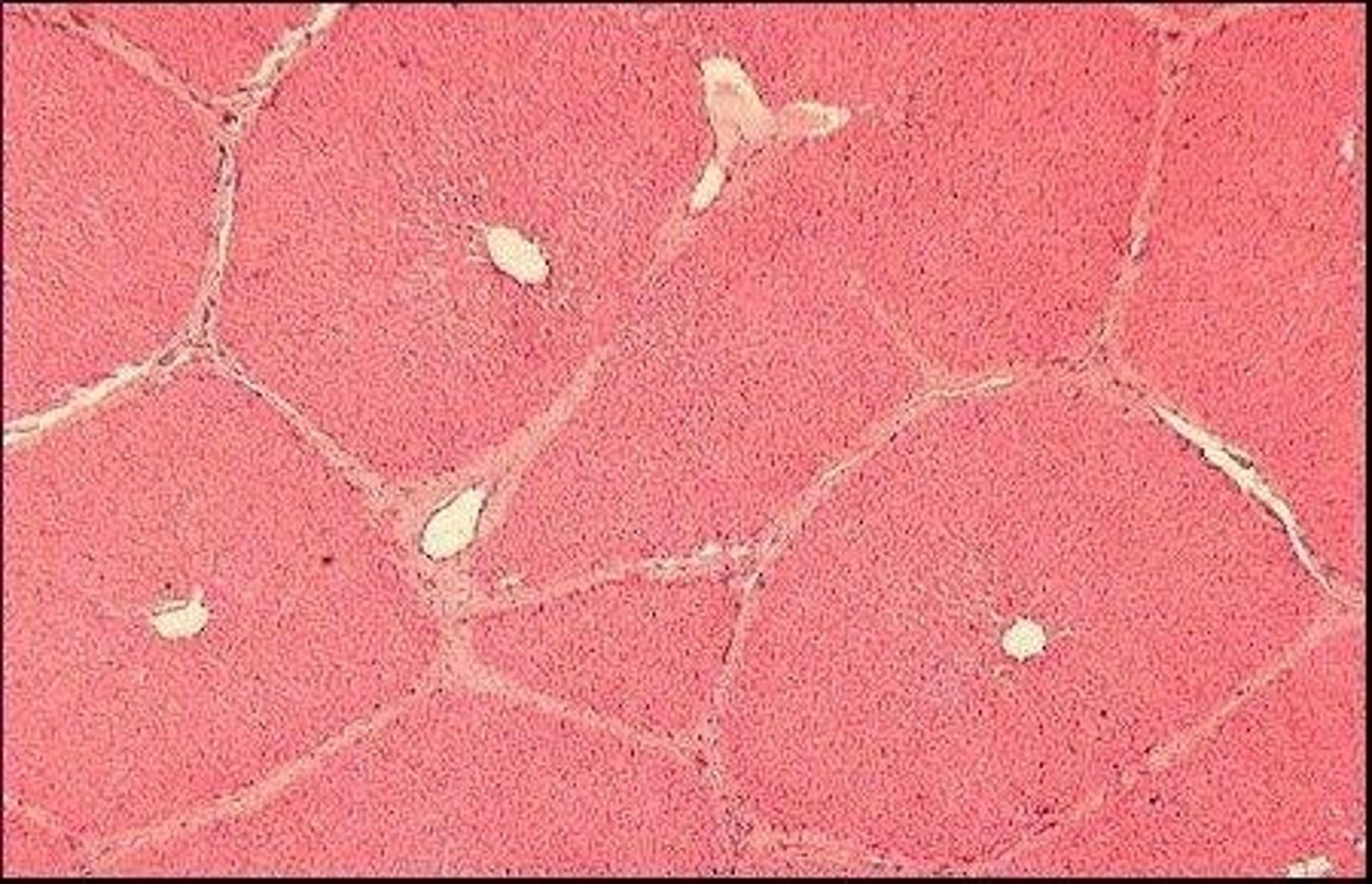 <p>The functional units of the liver.</p>
