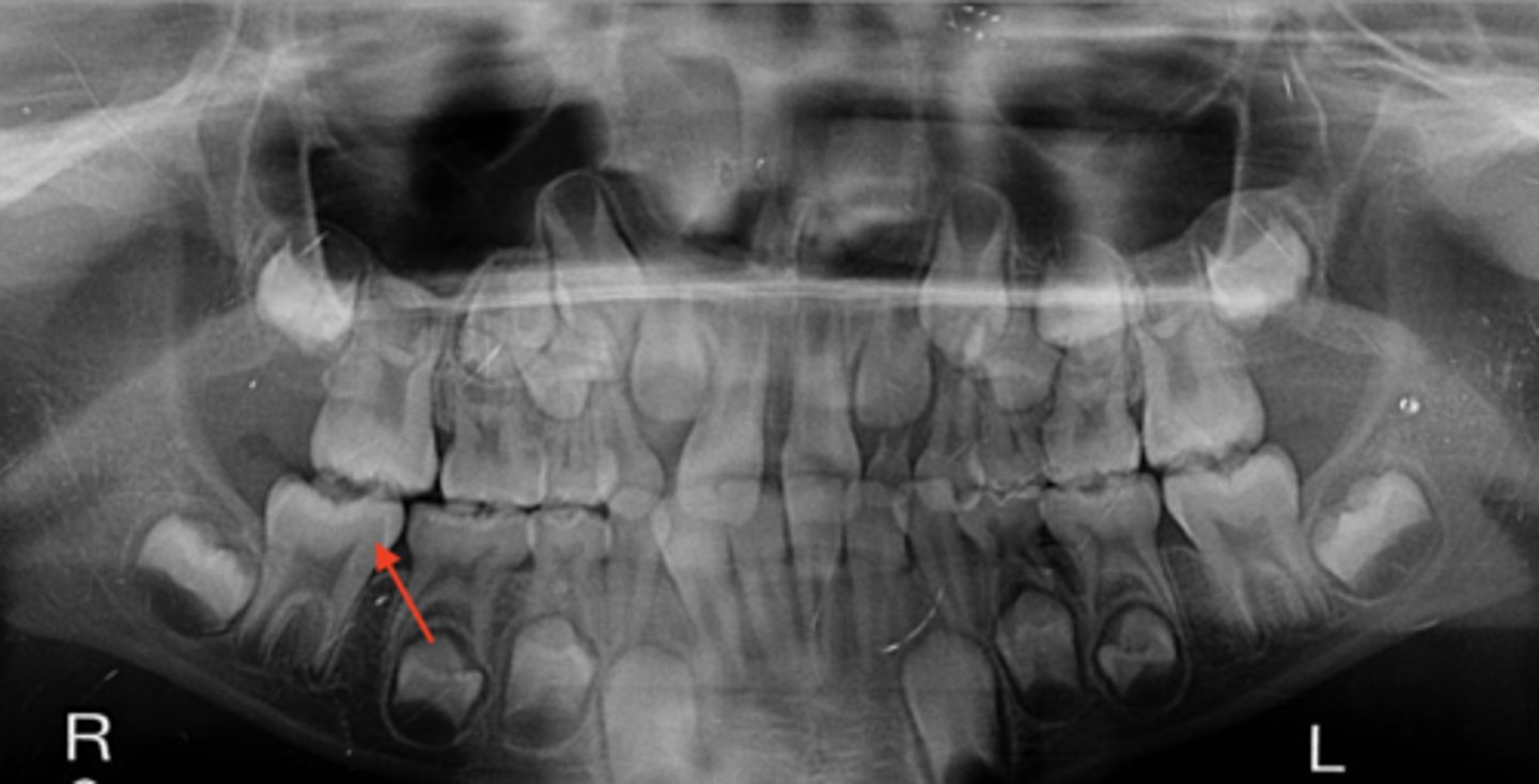 knowt flashcard image