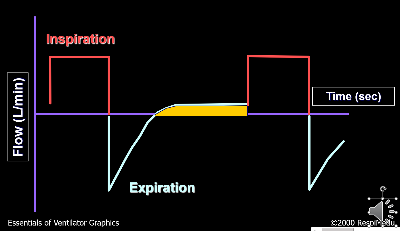 <p>What abnormality is shown in the picture?</p>