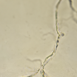 <ul><li><p>protein material</p></li><li><p>small amount normal</p></li><li><p>increased with poor collection and/or inflammation</p></li><li><p>easily confused with hyaline casts</p></li></ul><p></p>