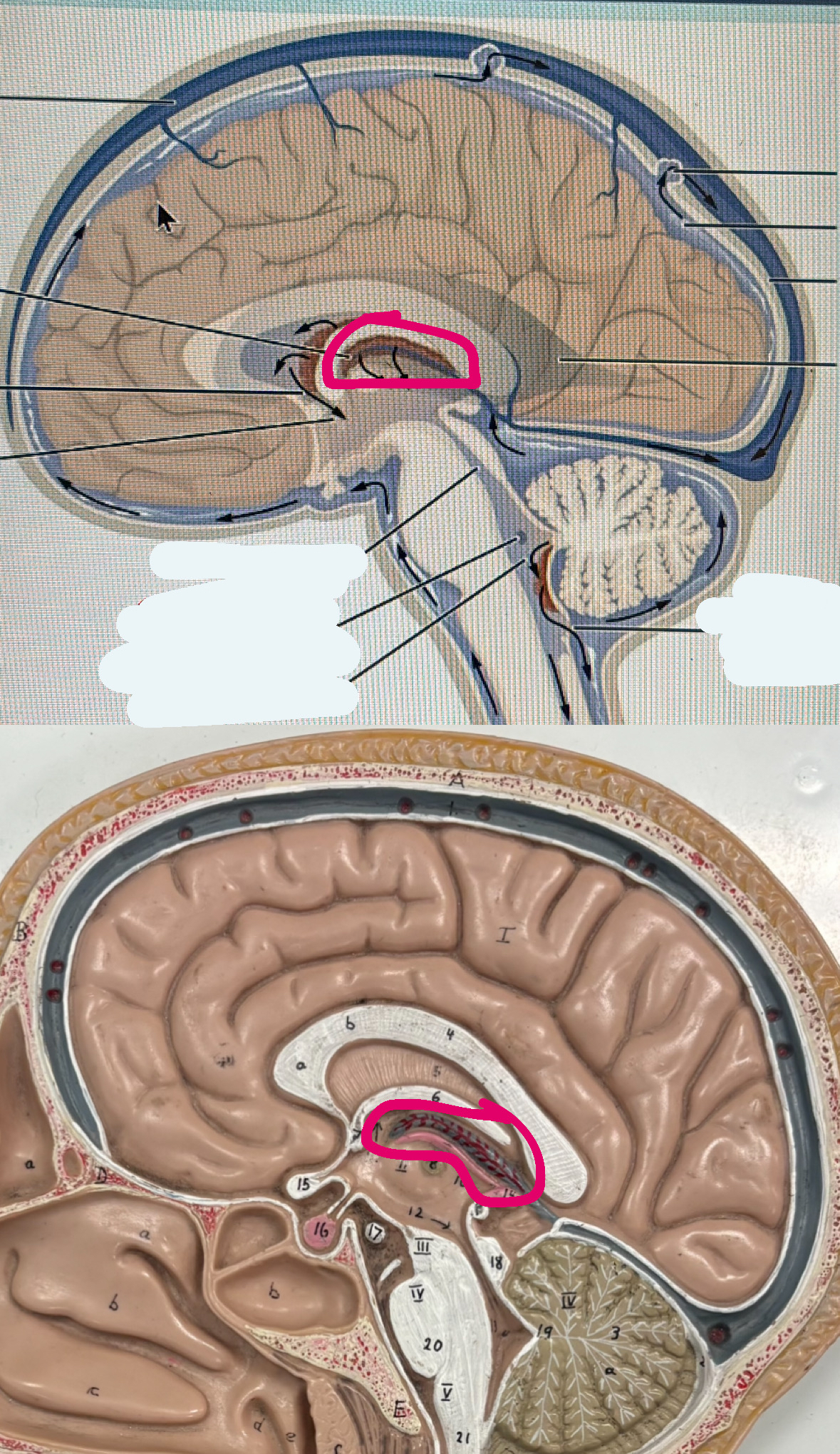 <p>the meaty worm </p>