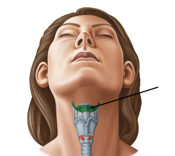 <p>What Facial Bone is this?</p>