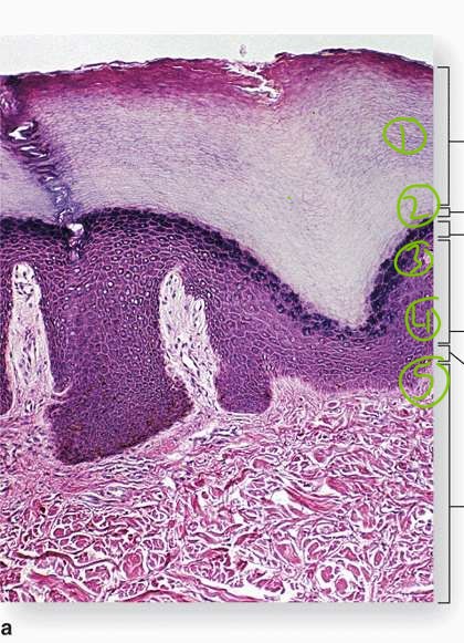 <p>name the five layers of epidermis</p>