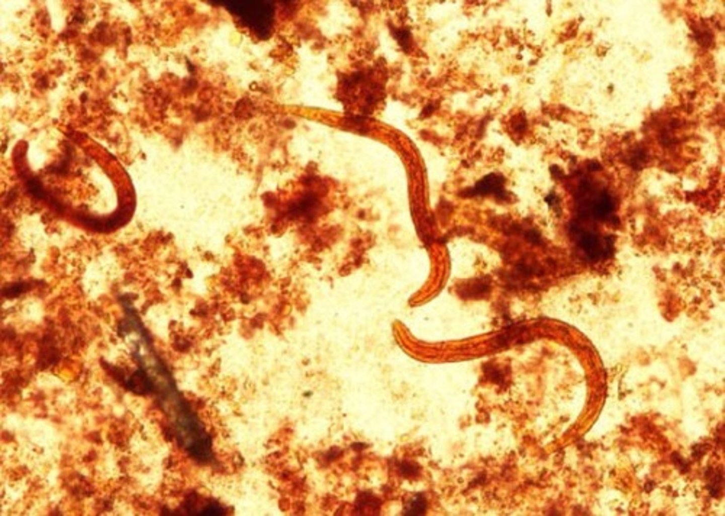 <p>Identify the parasite</p>