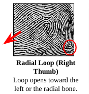 <p>Radial Loop</p>