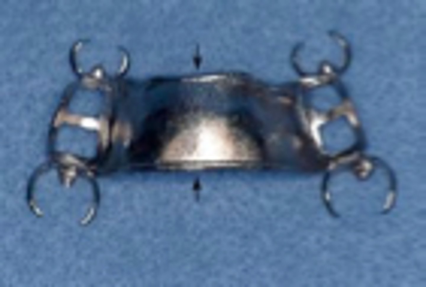 <p>Maxillary major connectors should have minor elevations at the borders that contact and place minor pressure on the palatal tissue; used to prevent food impaction under the partial</p>