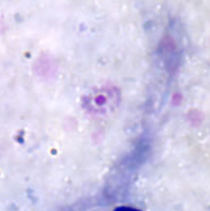 <p>Dr. Vicente Y. Belizario Jr.</p>