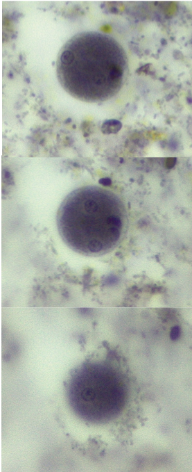 term image