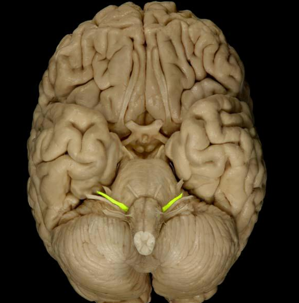 <p>List the nerve name, roman numeral, and function.</p>
