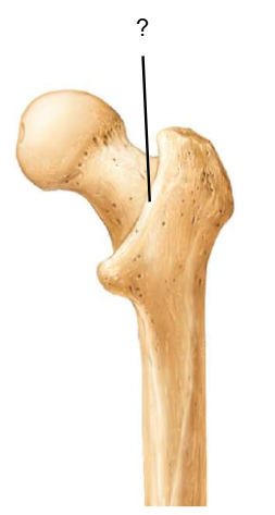 <p>Nom et caractéristiques de ce relief ?</p>