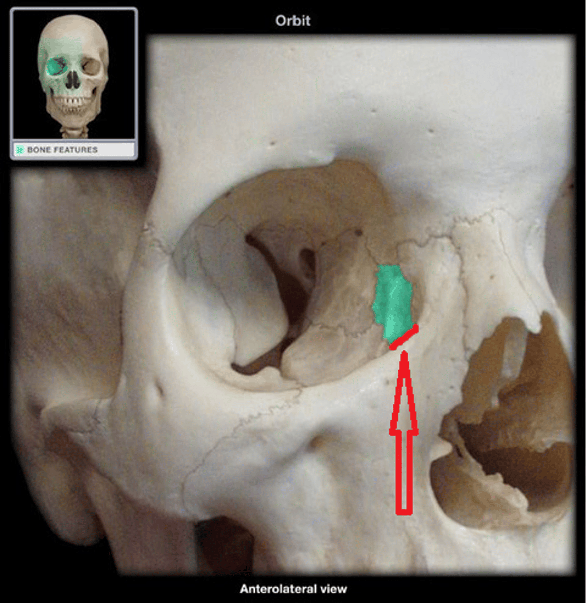<p>square outlined by sutures in lacrimal fossa</p>