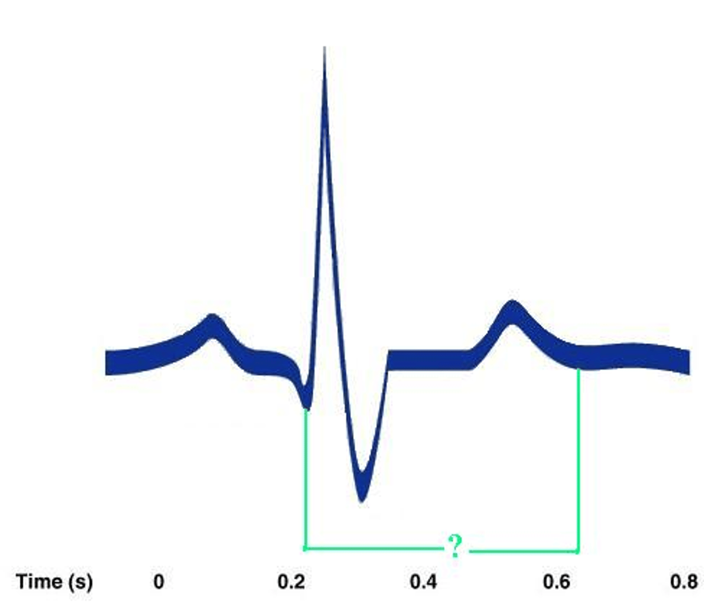 <p>Identify the indicated portion of the EKG.</p>