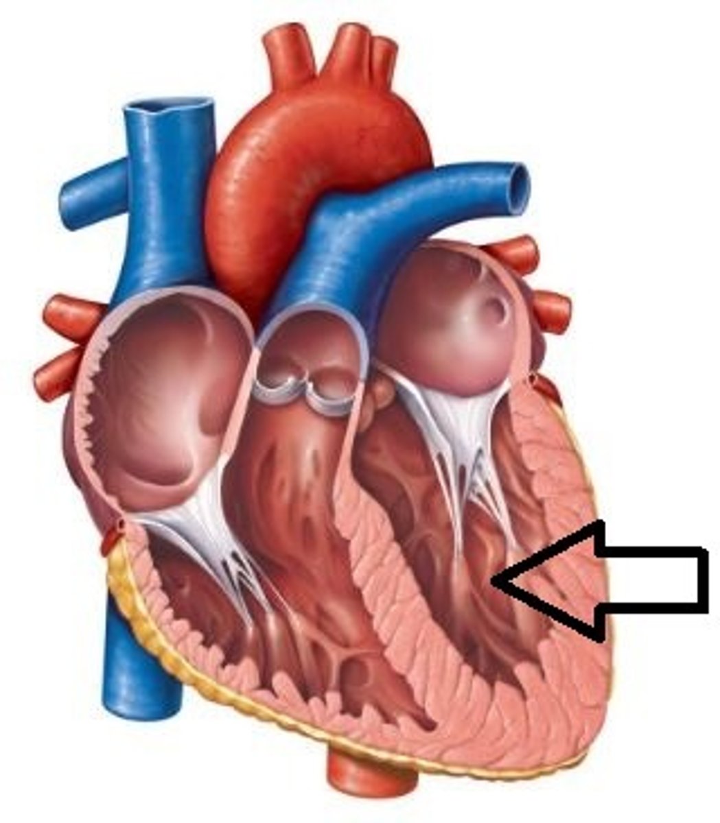 <p>What chamber of the heart is this?</p>