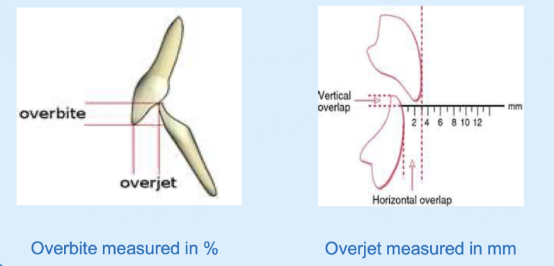 <ul><li><p><span style="background-color: transparent;">A measure of vertical and horizontal overlap&nbsp;</span></p></li><li><p><span style="background-color: transparent;">Overbite</span></p><ul><li><p>how much the upper central incisor overlaps the lower central incisors&nbsp;</p></li><li><p><span style="background-color: transparent;">measured in % </span></p></li></ul></li><li><p><span style="background-color: transparent;">Overjet </span></p><ul><li><p>the distance between the lingual surface of the upper central incisor to buccal surface of the lower central incisors&nbsp;</p></li><li><p><span style="background-color: transparent;">measured in mm</span></p></li></ul></li></ul><p></p>