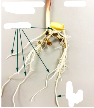 <p>What are the multiple arrows pointing to in this root system?</p>