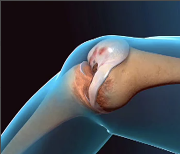 what injury is this?