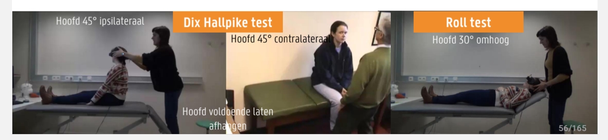 <p>Onderzoek van de VOR na prikkeling van de HCK door <br>positieveranderingen<br></p><p>INTERPRETATIE</p><ul><li><p>Typische nystagmus BPPV post SCC (upbeating rotatoir)</p></li><li><p> Typische nystagmus BPPV hor SCC (horizontaal)</p></li><li><p>Atypische nystagmus => perifeer/centraal</p></li></ul><p></p><p>Positioneringstest = Dix Hallpiketest<br>Positietest = Roll test̶ Normaal: stabiele ogen</p>