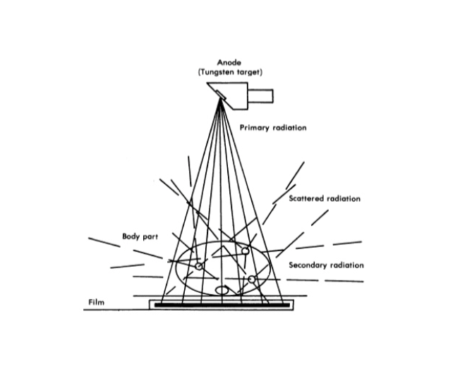 <p><strong>HOW does <u>Thickness of the Object</u> influence Scatter?</strong></p>
