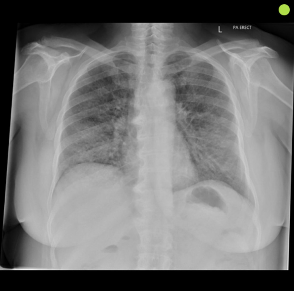 <p>Name the condition</p>