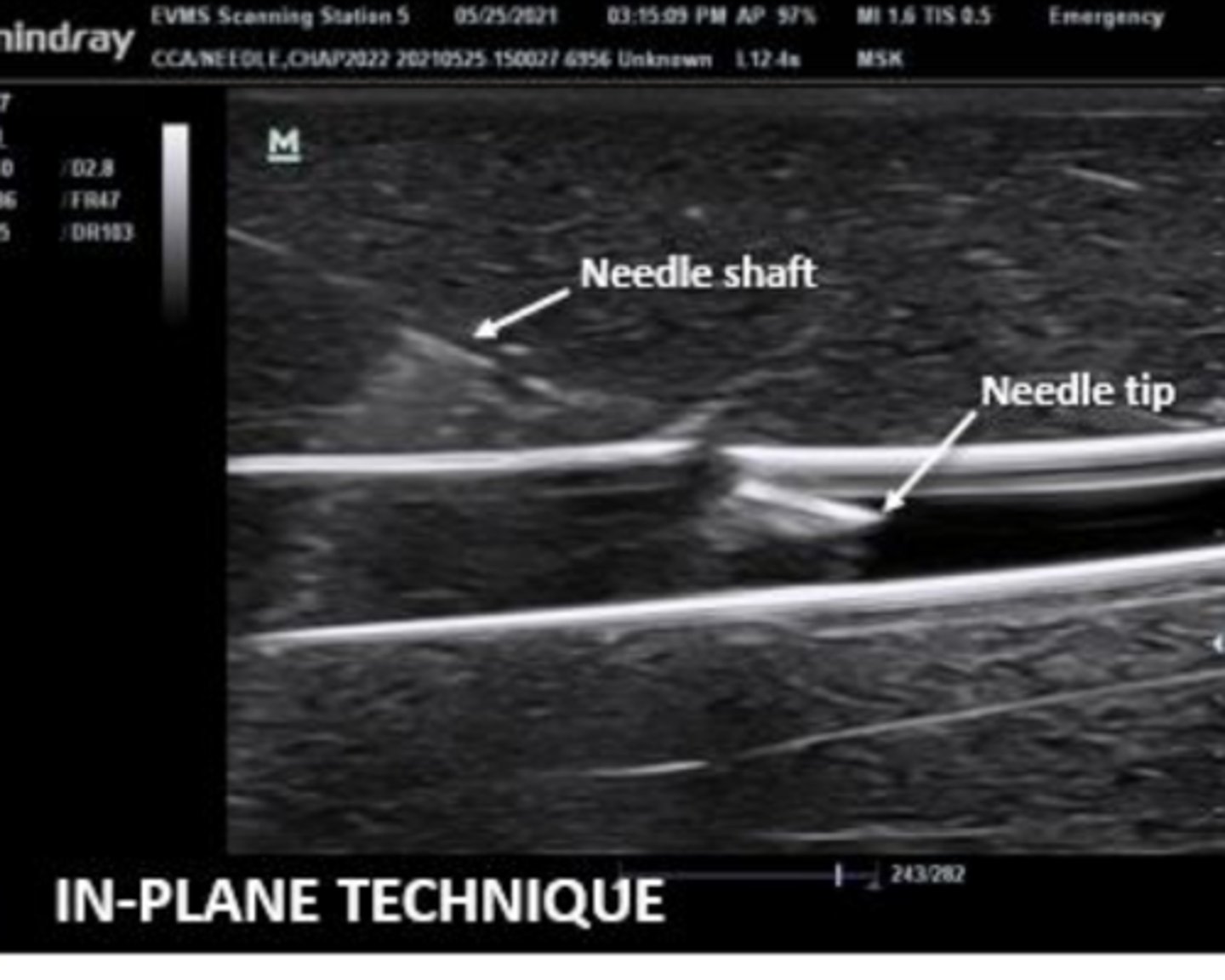 knowt flashcard image