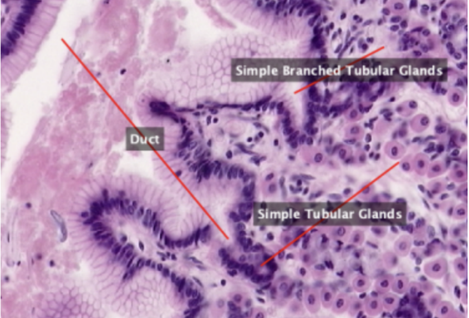 <p>What organ specimen is shown in this slide?</p>