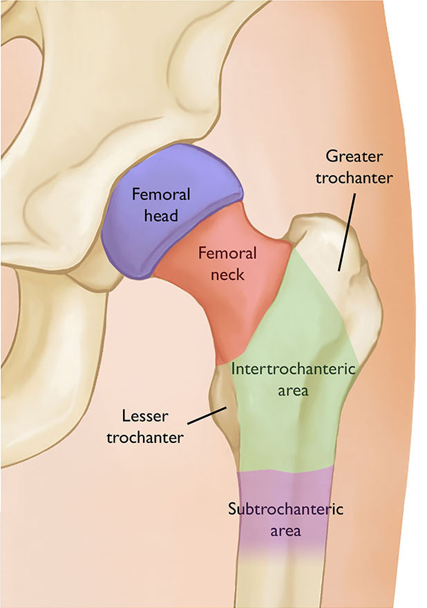 <p><strong>LARGE, BLUNT BUMP ONLY</strong> on the FEMUR (there’s 2)</p><ul><li><p><strong>BONY PROJECTION</strong></p></li><li><p>Typically in the appendicular skeleton</p></li></ul><p><span style="color: #ec1010"><strong>Think TROJAN for the TRO part and Trojan is kinda BIG/LARGE </strong></span></p>