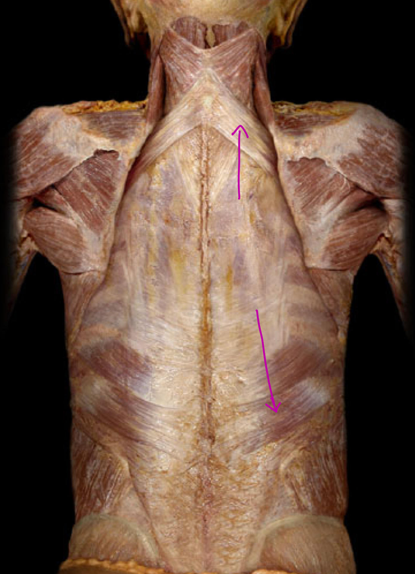 <p>What is this mm group called?</p><p>What mm are in this group?</p><p>Innervation?</p>