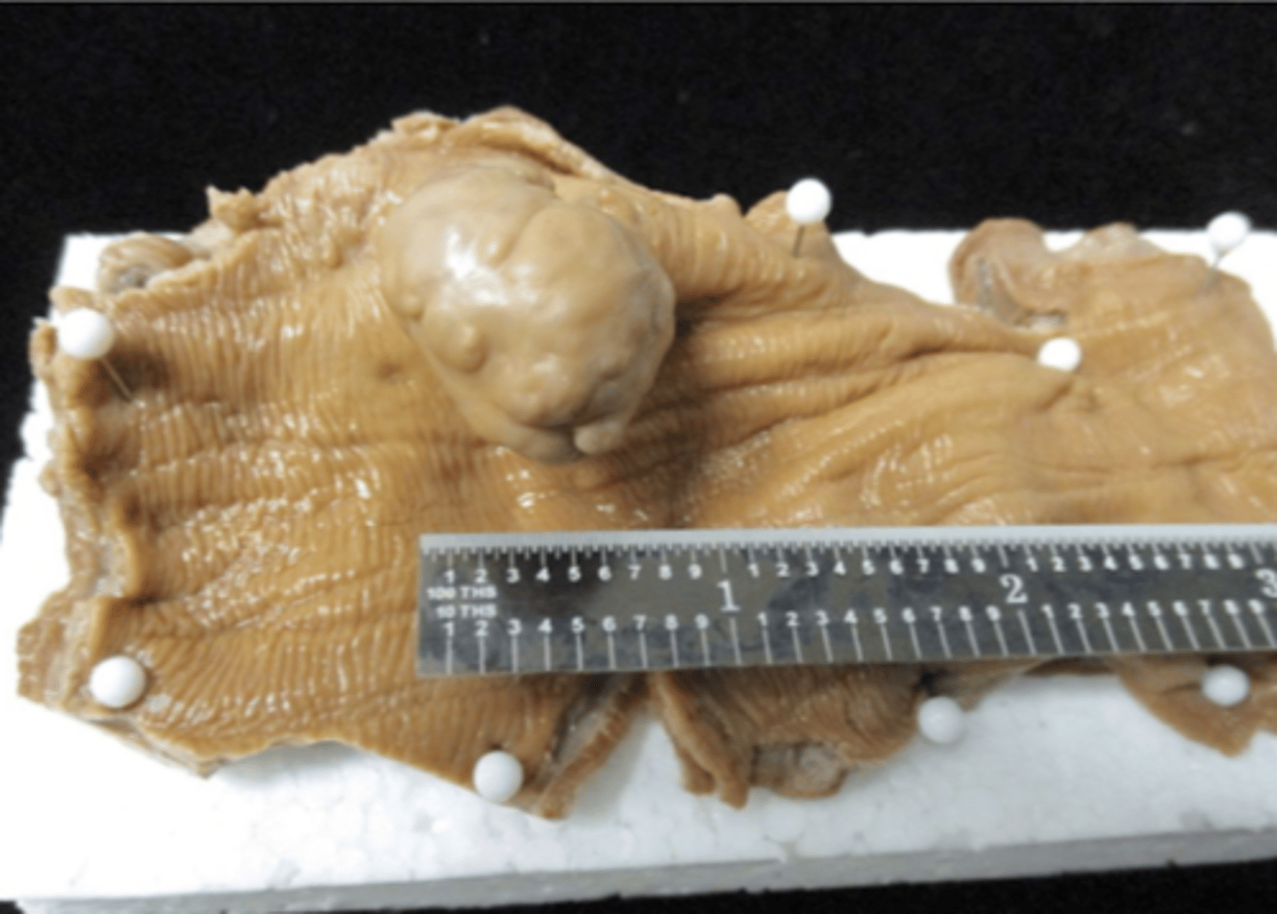 <p>what parasite makes these characteristic nodules in the esophagus of cats and dogs?</p>