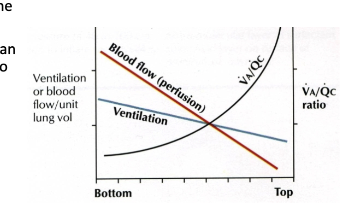 <p>↑ pulmonary blood flow (not ↑ resistance).</p>