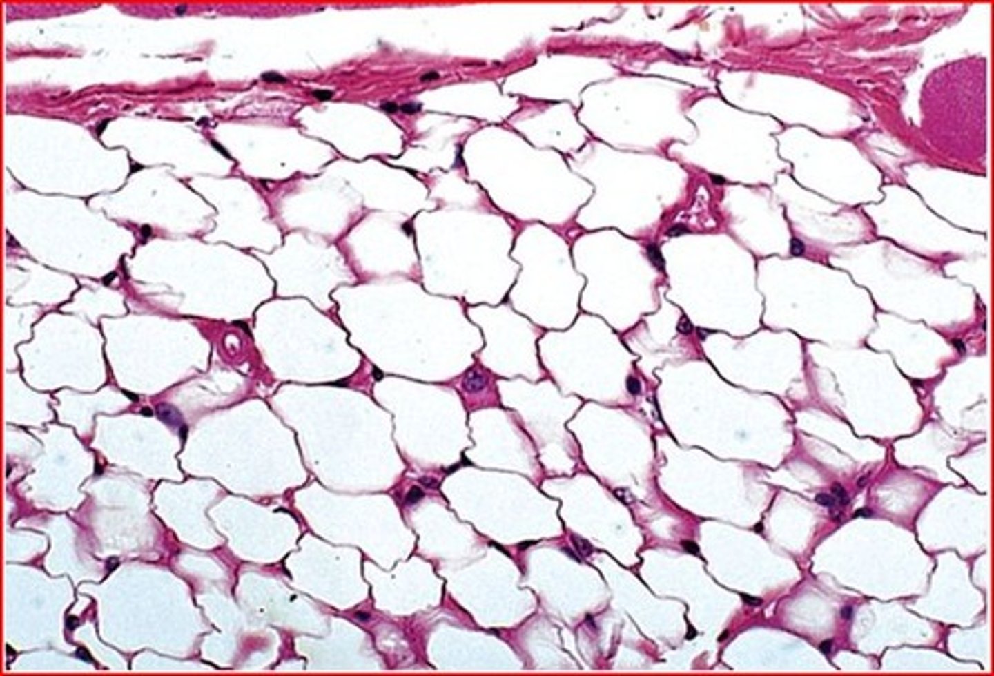 <p>Visceral fat</p>