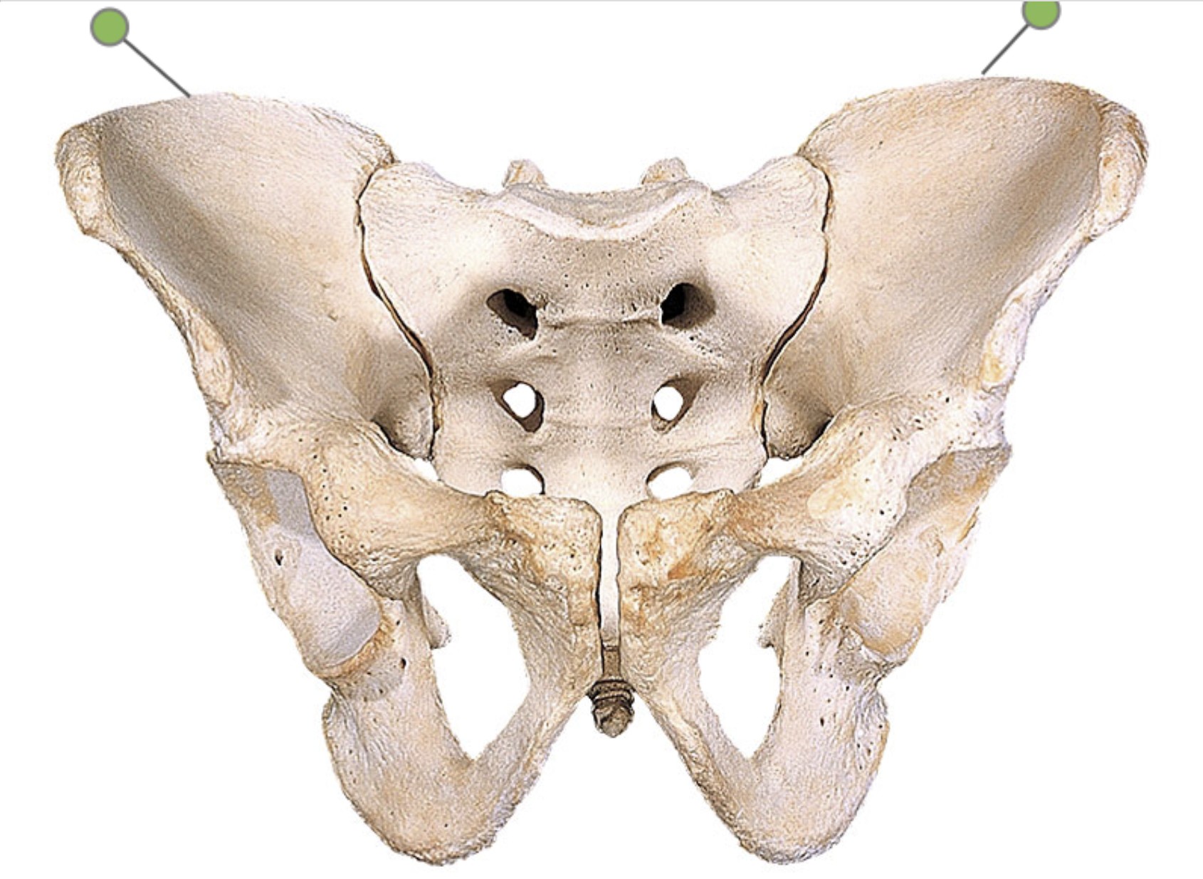 <p>Which bone landmark of the pelvic girdle is at the top of the hip bone?</p>
